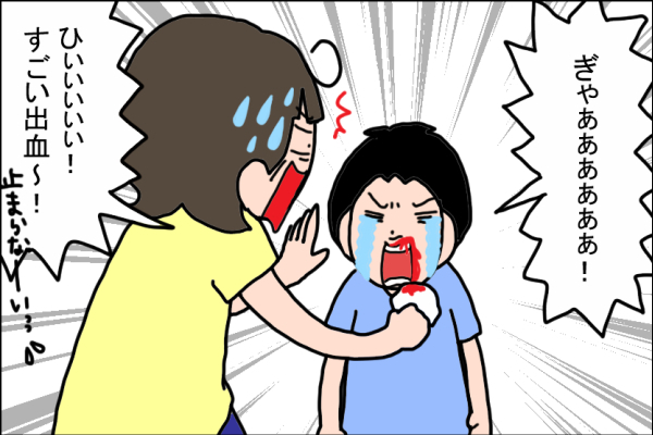 ケガが絶えない息子、男の子ママとして覚悟を決めたこと【うちの家族、個性の塊です Vol.13】