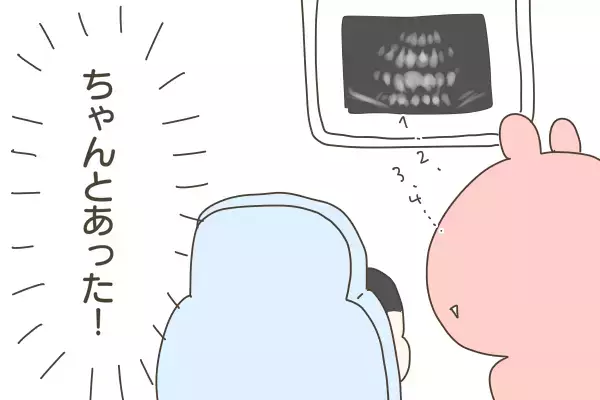 ハート型の乳歯「癒合歯」が生えてきた次男。果たして永久歯は無事2本生えてくるのか…!?【産後太りこじらせ母日記 第58話】