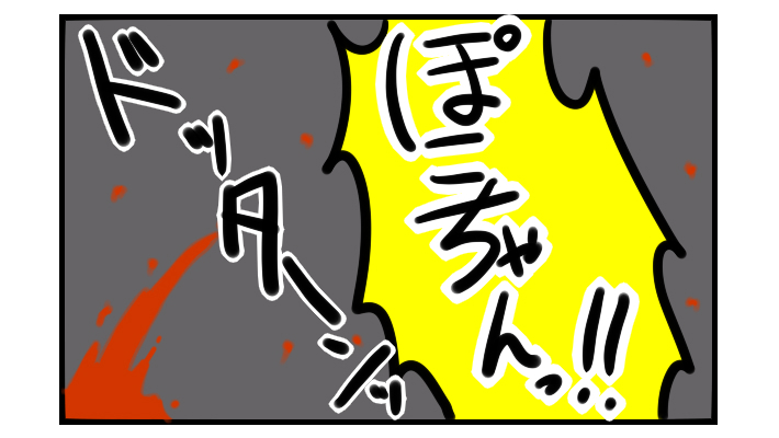 まさかの大惨事に! 階段から落ちた息子のケガが大変だった話【ぽこちゃんです&どんちゃんです Vol.4】