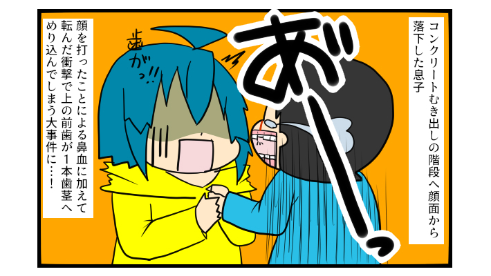 まさかの大惨事に! 階段から落ちた息子のケガが大変だった話【ぽこちゃんです&どんちゃんです Vol.4】