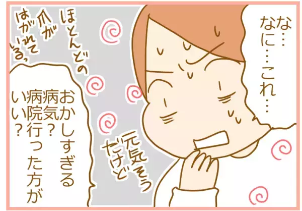 子どもの爪がはがれてる！ 手足口病の意外すぎる後遺症にパニック！【ふたごむすめっこ×すえむすめっこ 第48話】