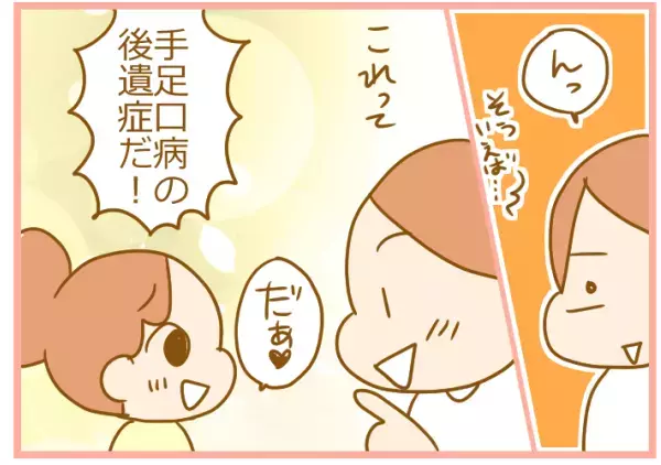 子どもの爪がはがれてる！ 手足口病の意外すぎる後遺症にパニック！【ふたごむすめっこ×すえむすめっこ 第48話】