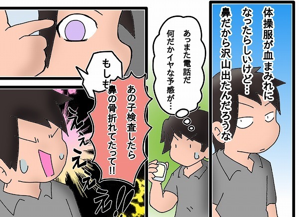 次女が鼻骨折で即入院・手術に!!　急な準備で慌てないための心構え【もりりんパパと怪獣姉妹 第19話】