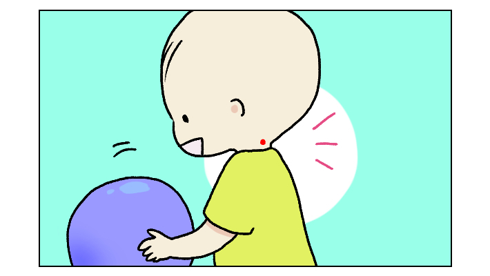 双子の妹に「イチゴ状血管腫」が！ 不安になりつつも経過を見守っていたところ…!?【四方向へ散らないで Vol.5】