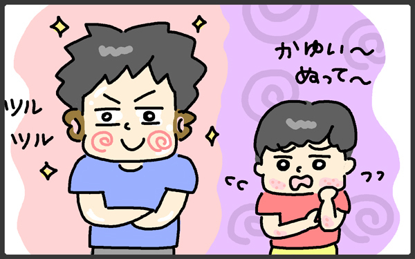 子どもの肌は繊細！ 乾燥や寒さだけじゃないアレルギーが原因の場合も【メンズかーちゃん～うちのやんちゃで愛おしいおさるさんの物語～ 第74回】