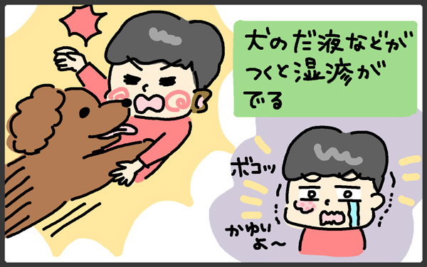 子どもの肌は繊細！ 乾燥や寒さだけじゃないアレルギーが原因の場合も【メンズかーちゃん～うちのやんちゃで愛おしいおさるさんの物語～ 第74回】