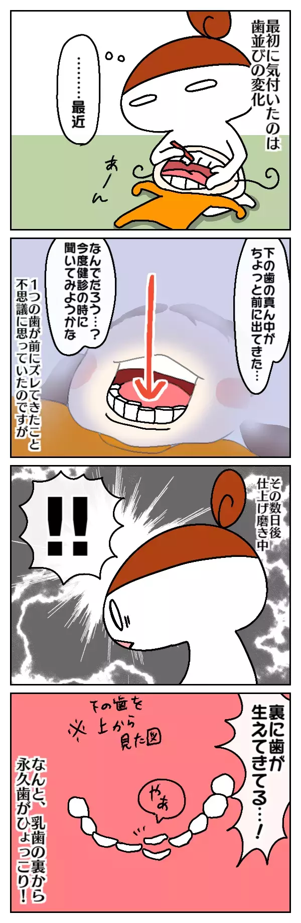 前歯がずれてきてると思ったら、5歳娘に初めての永久歯が！（前編）【ムスメちゃんとオコメちゃん  第44話】