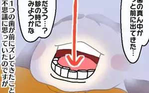 前歯がずれてきてると思ったら、5歳娘に初めての永久歯が！（前編）