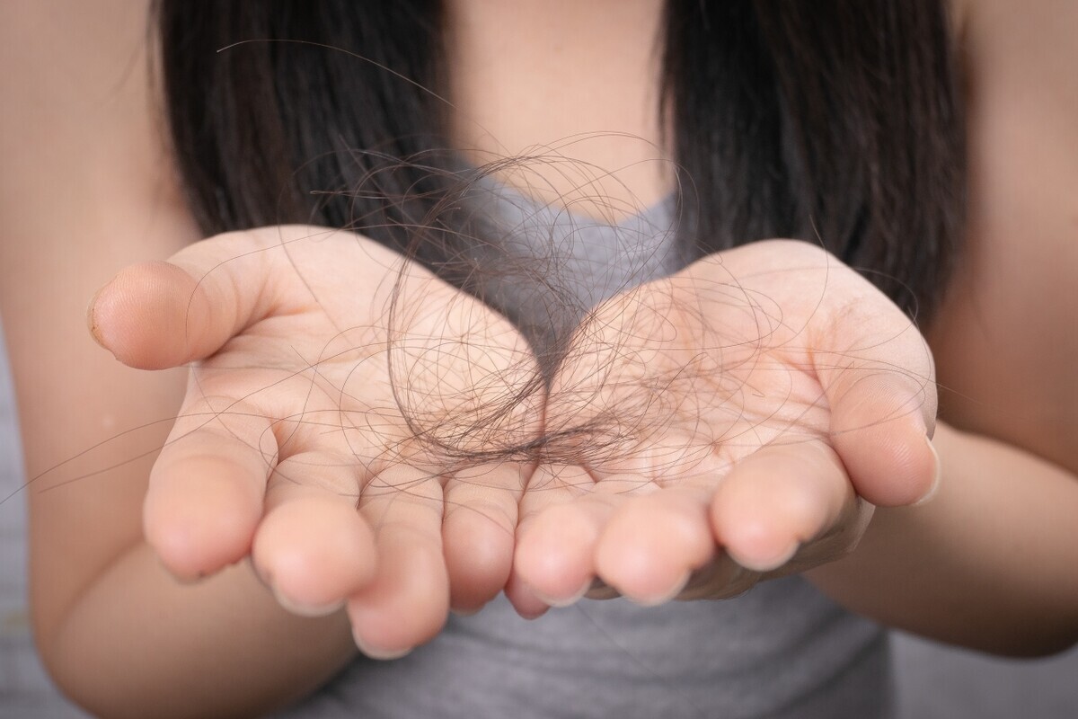 医師監修 髪の毛がどんどん抜ける 抜け毛の理由と対策方法 ウーマンエキサイト 1 2