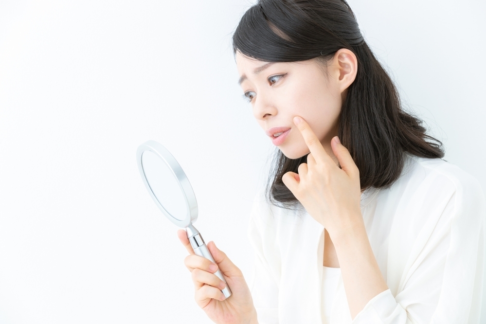 【医師監修】ニキビをつぶすのはNG！　正しいケア方法を知っておこう
