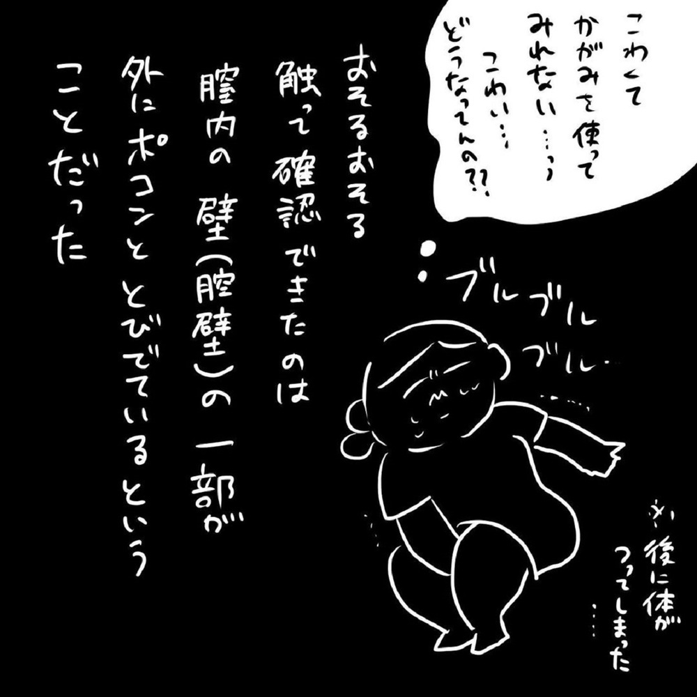産後の尿漏れと思いきや、まさかの事態に…私の股から何かが出ている!?【いいから黙ってだいてくれ！ Vol.13】
