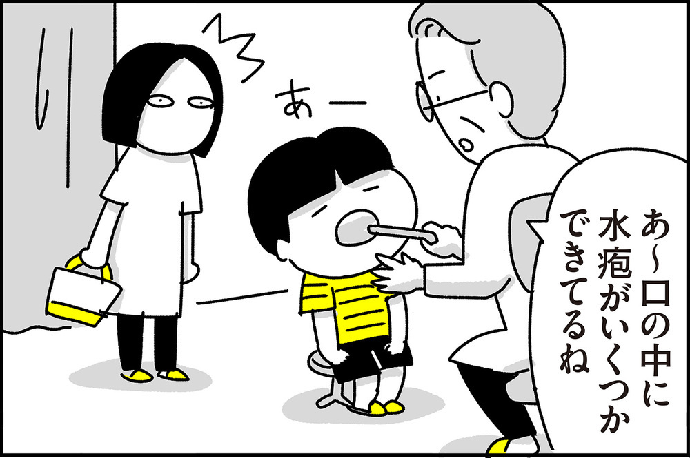 ショッキングなビジュアルに焦った…手足口病の思い出【ちょっ子さんちの育児あれこれ 第20話】