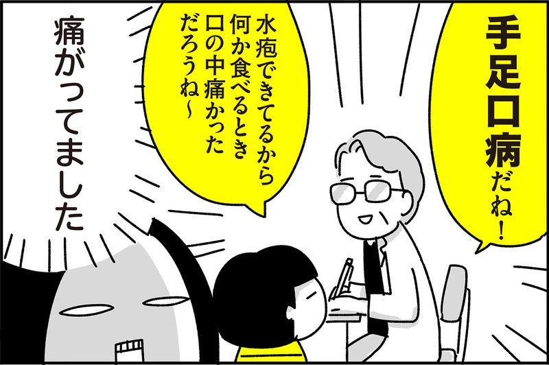 ショッキングなビジュアルに焦った…手足口病の思い出【ちょっ子さんちの育児あれこれ 第20話】