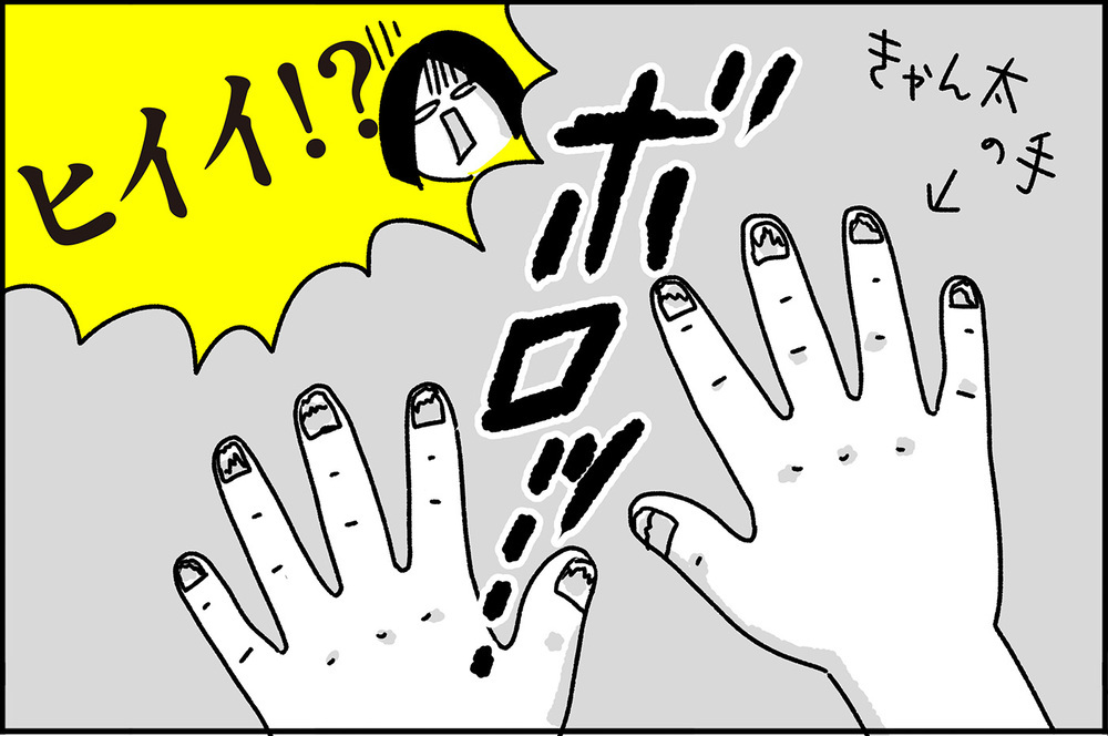 ショッキングなビジュアルに焦った…手足口病の思い出【ちょっ子さんちの育児あれこれ 第20話】