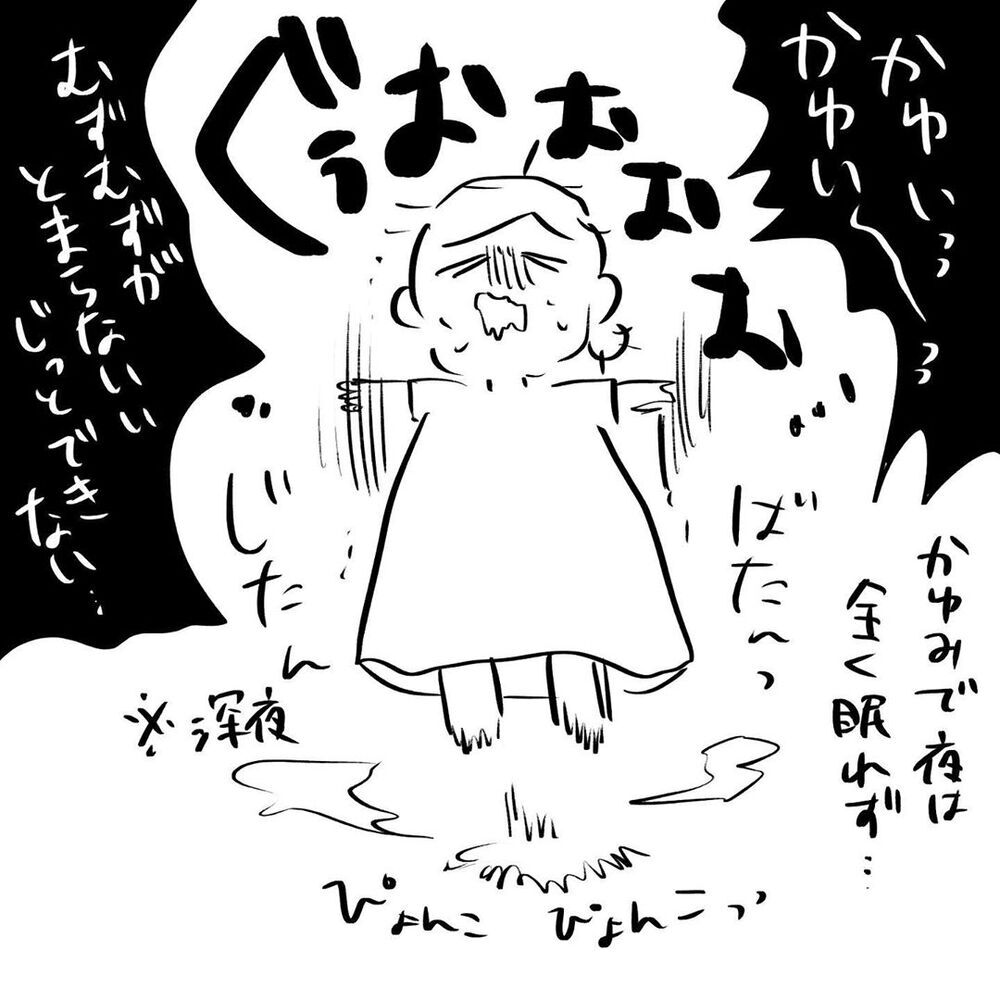 【激しい体調悪化】手の赤み・かゆみ・曲げられないほどの関節痛… 一体どうなっているの⁉【4人目と5人目の話  Vol.16】