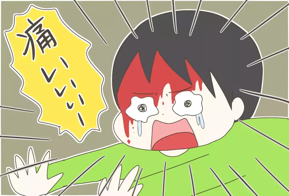 トランポリンで顔面血だらけに…！ 家庭内でのケガを予防するために注意すべきこと【産後太りこじらせ母日記 第85話】