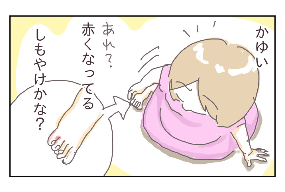 産休ライフを楽しむはずが、まさかの水虫!? 悪化する症状、そのとき夫は…【シャトー家の観察絵日記 Vol.15】