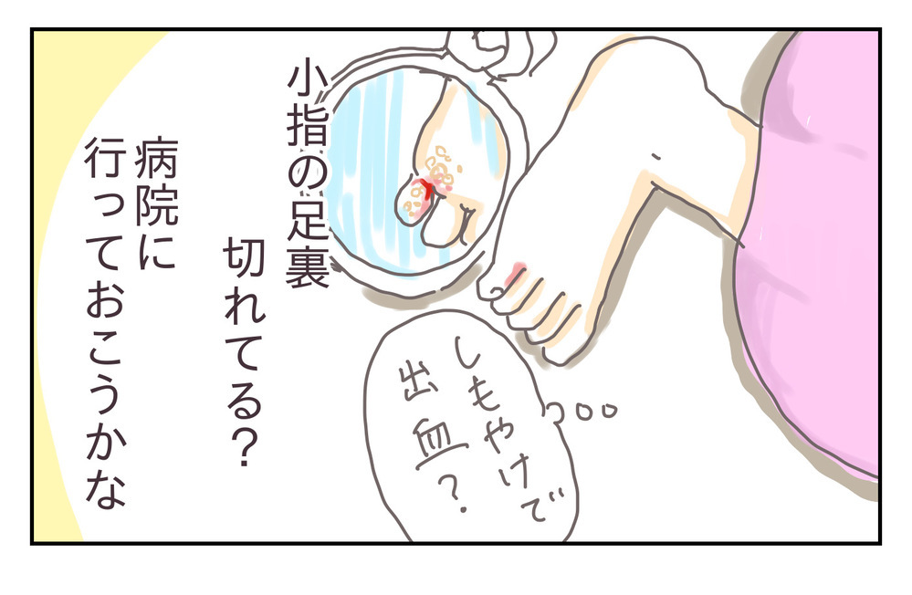 産休ライフを楽しむはずが、まさかの水虫!? 悪化する症状、そのとき夫は…【シャトー家の観察絵日記 Vol.15】