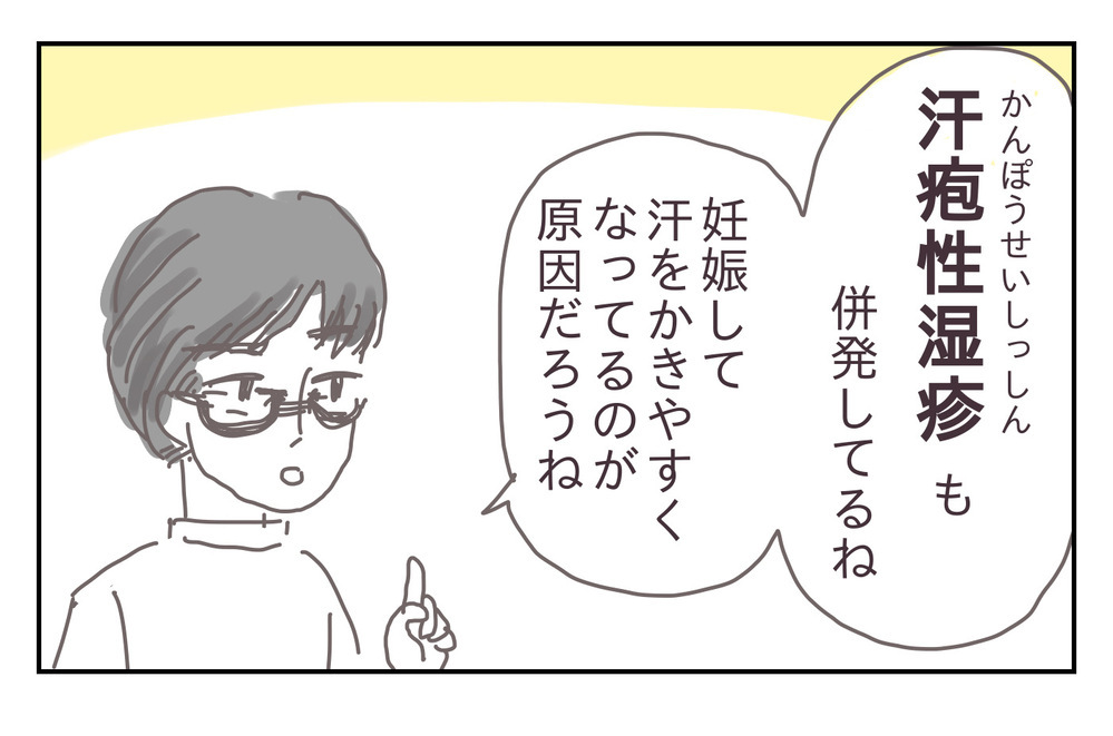 産休ライフを楽しむはずが、まさかの水虫!? 悪化する症状、そのとき夫は…【シャトー家の観察絵日記 Vol.15】