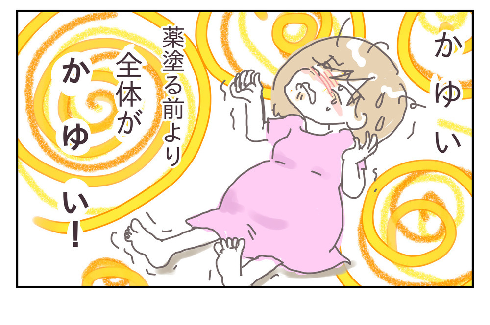 産休ライフを楽しむはずが、まさかの水虫!? 悪化する症状、そのとき夫は…【シャトー家の観察絵日記 Vol.15】