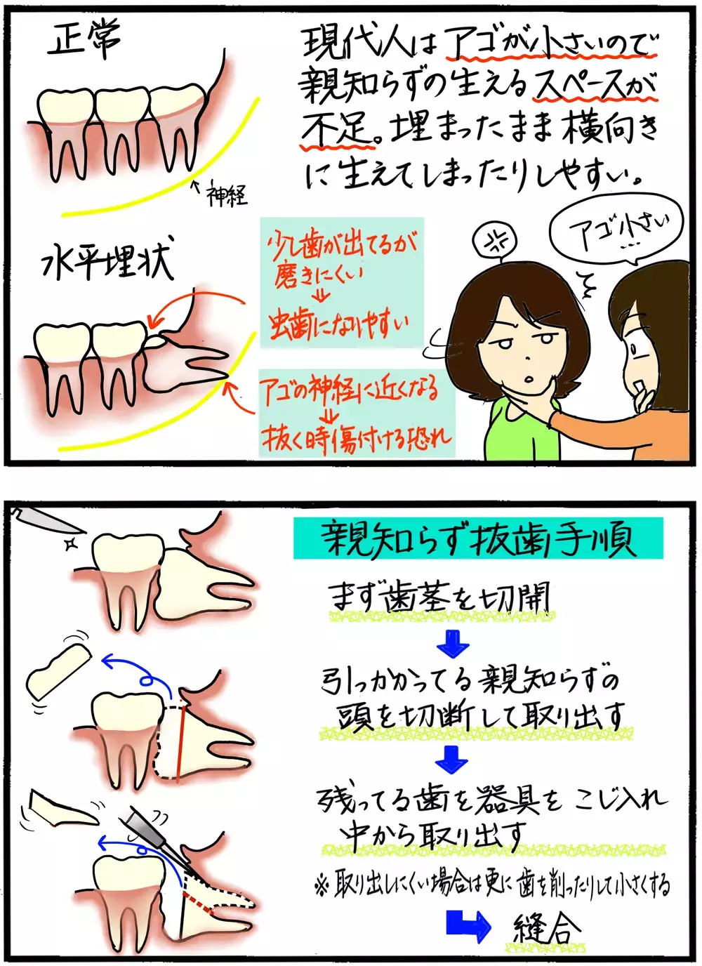 親知らずは抜かなきゃいけない？ 抜く抜かないの判断基準は…【4人の子育て！　愉快なじゃがころ一家 Vol.71】