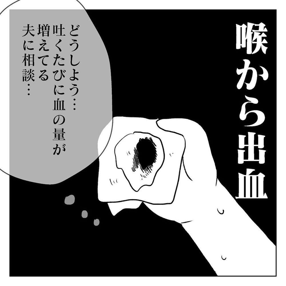 悪阻がひどくなり喉から出血、でも夫には相談できない【天国と地獄　結婚式と悪阻物語 Vol.7】