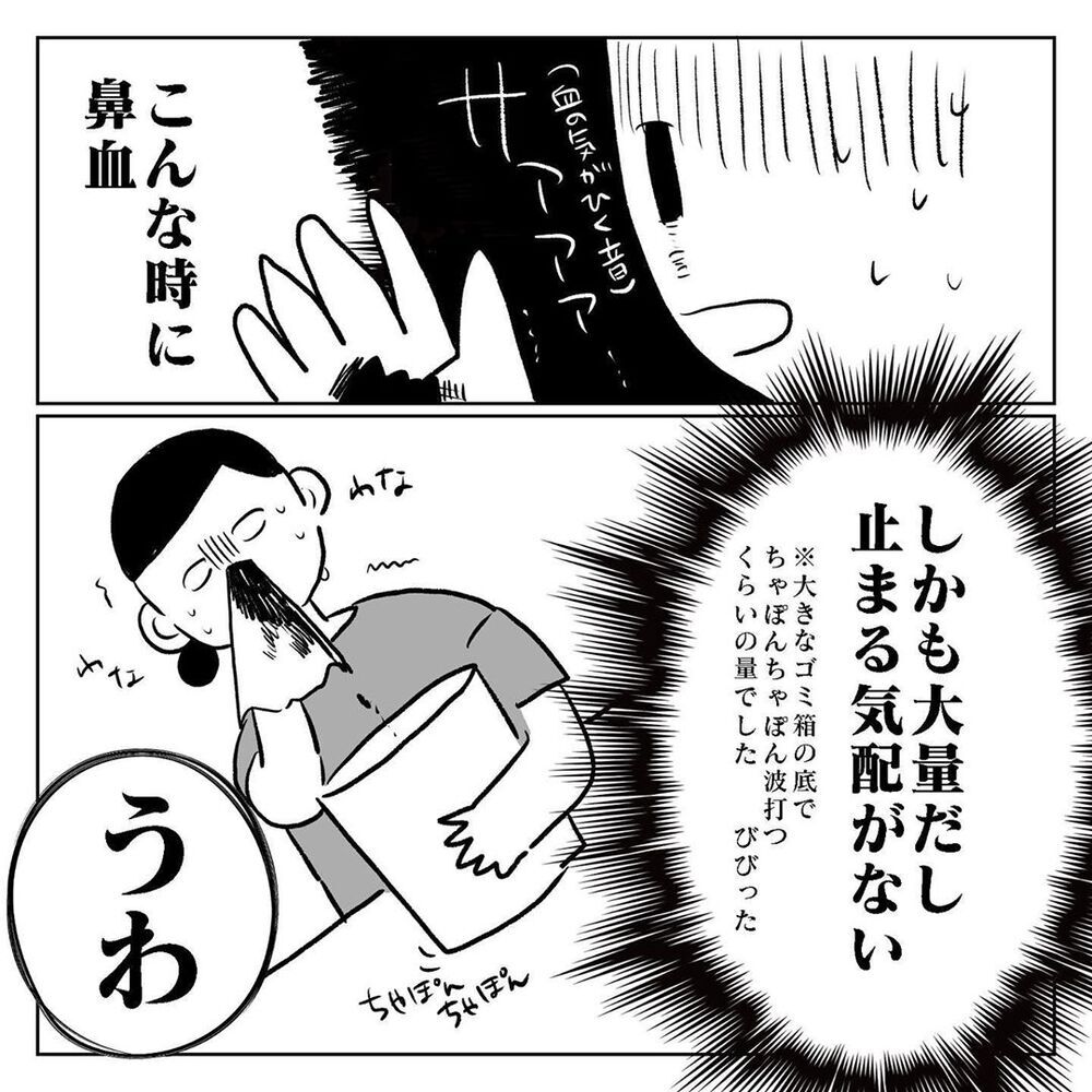 突然の鼻血に夫の辛辣な一言、この頃何をやってもうまくいかない【天国と地獄　結婚式と悪阻物語 Vol.11】