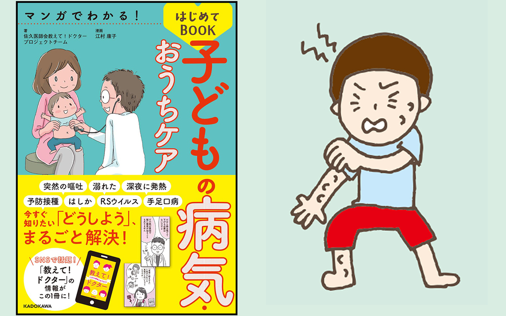 【医師監修】虫刺されは小さい子ほど要注意！ 虫よけ剤、かゆみ止めの正しい対処法【子どもの「病気・けが」教えて！ドクター 第4回】