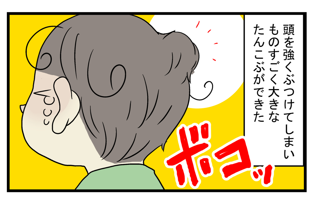 まるで漫画の表現のよう…次男がダイナミックに転んでできた「大きなたんこぶ」【こどもと見つけた小さな発見日誌 Vol.27】
