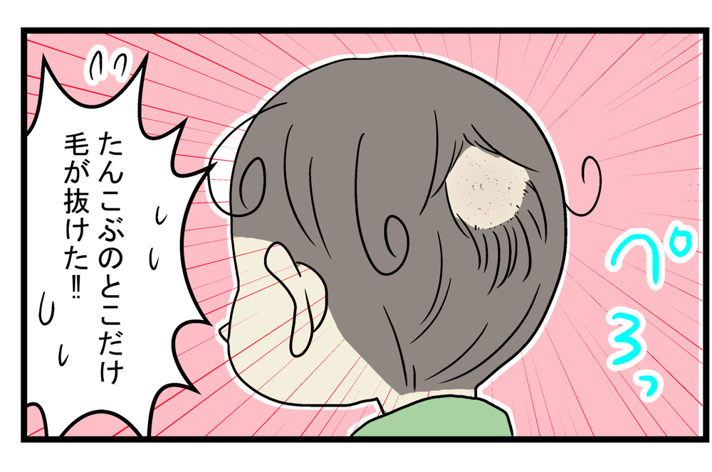 まるで漫画の表現のよう…次男がダイナミックに転んでできた「大きなたんこぶ」【こどもと見つけた小さな発見日誌 Vol.27】