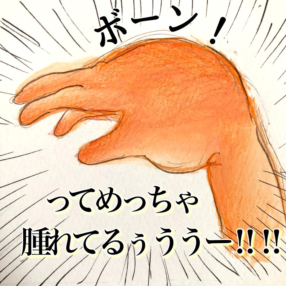 川崎病のステロイド治療がスタート、副作用や入院期間に衝撃…！【長男の川崎病と職場の板挟みで大変だった話 Vol.8】