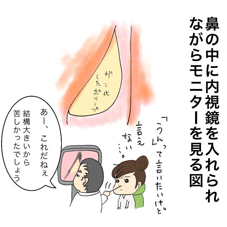 いよいよ大病院での診察、数々の検査や説明で治療の恐怖が増していく…【鼻腔ガンになった話 Vol.6】