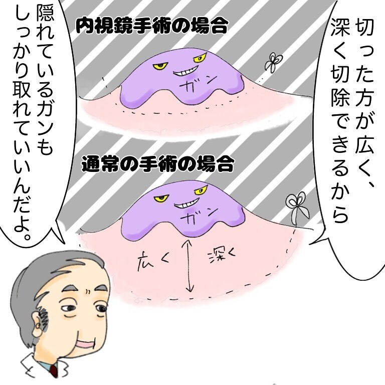 鼻を開く…!?　切開手術の説明が怖すぎる…【鼻腔ガンになった話 Vol.12】