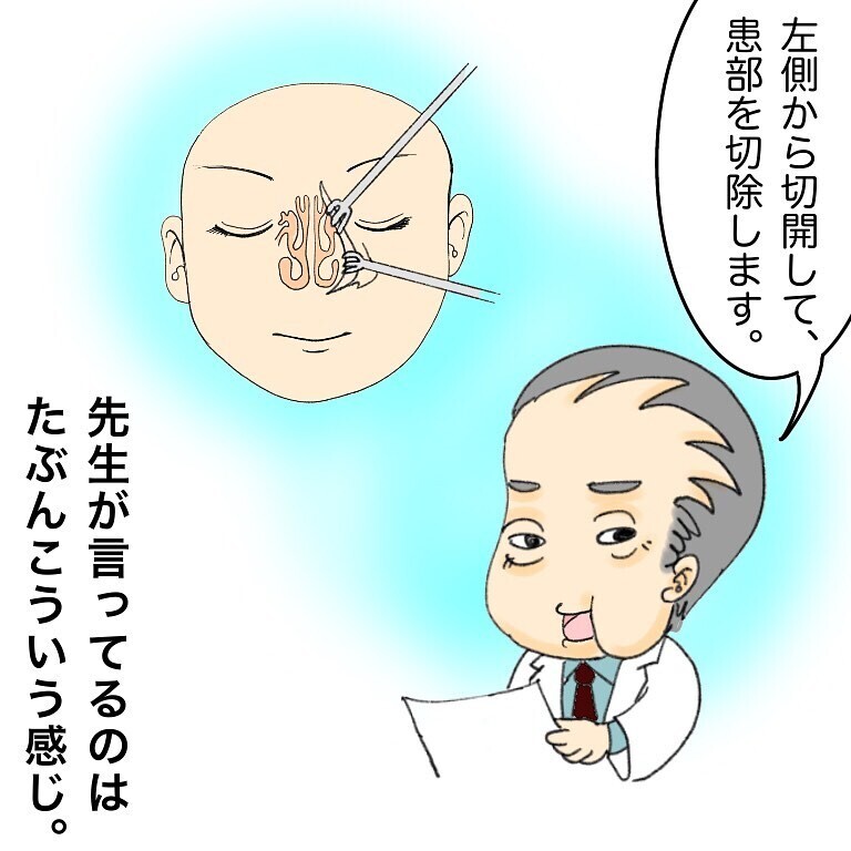 鼻を開く…!?　切開手術の説明が怖すぎる…【鼻腔ガンになった話 Vol.12】