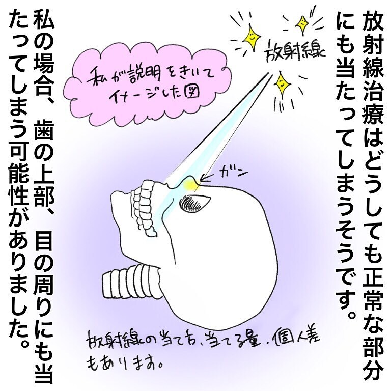 久しぶりにお世話される側に…、普段とは違うゆっくりした朝が新鮮すぎる【鼻腔ガンになった話 Vol.13】