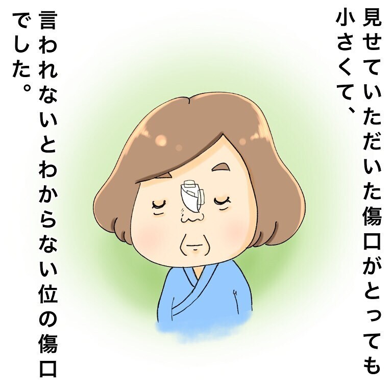 初めてできたガン友！ 切開した傷口を見せてもらえることに…【鼻腔ガンになった話 Vol.15】