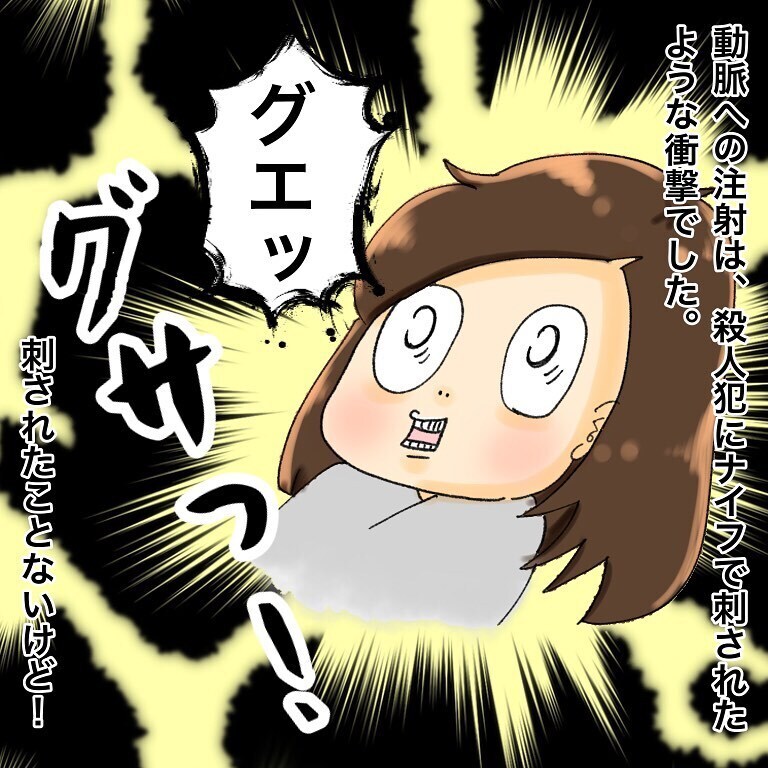 執刀医はまさかの新米先生?!　そして右腕に激痛が…！【鼻腔ガンになった話 Vol.20】