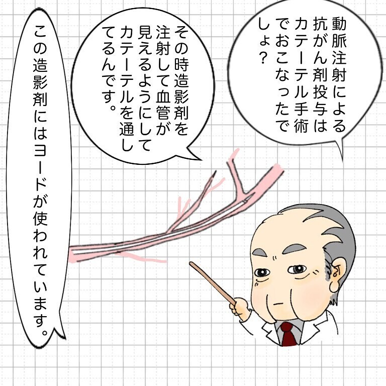 ヨードアレルギーが発覚 抗がん剤治療にどんな影響が 鼻腔ガンになった話 Vol 24 ウーマンエキサイト 1 2