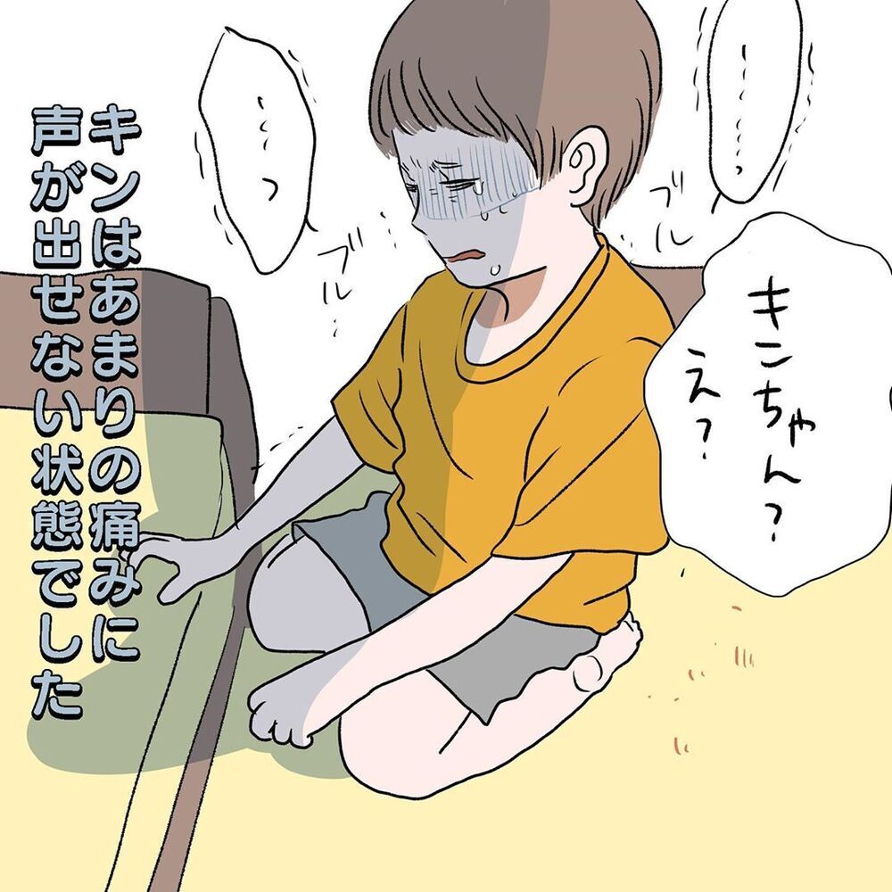 子育て8年目、子どものケガは突然に…！　叫び声の先に居たわが子は…!?【初めての子どもの大けが Vol.1】