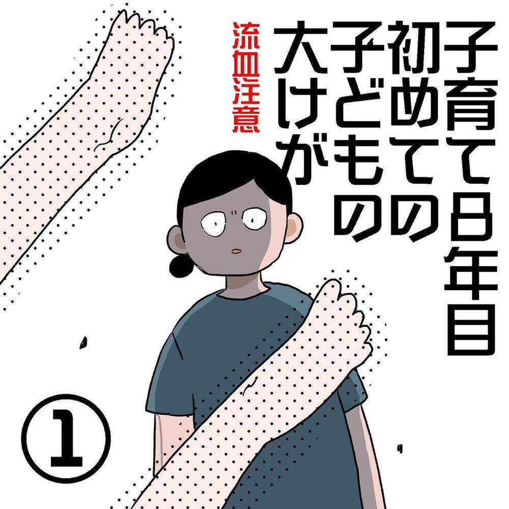 子育て8年目、子どものケガは突然に…！　叫び声の先に居たわが子は…!?【初めての子どもの大けが Vol.1】