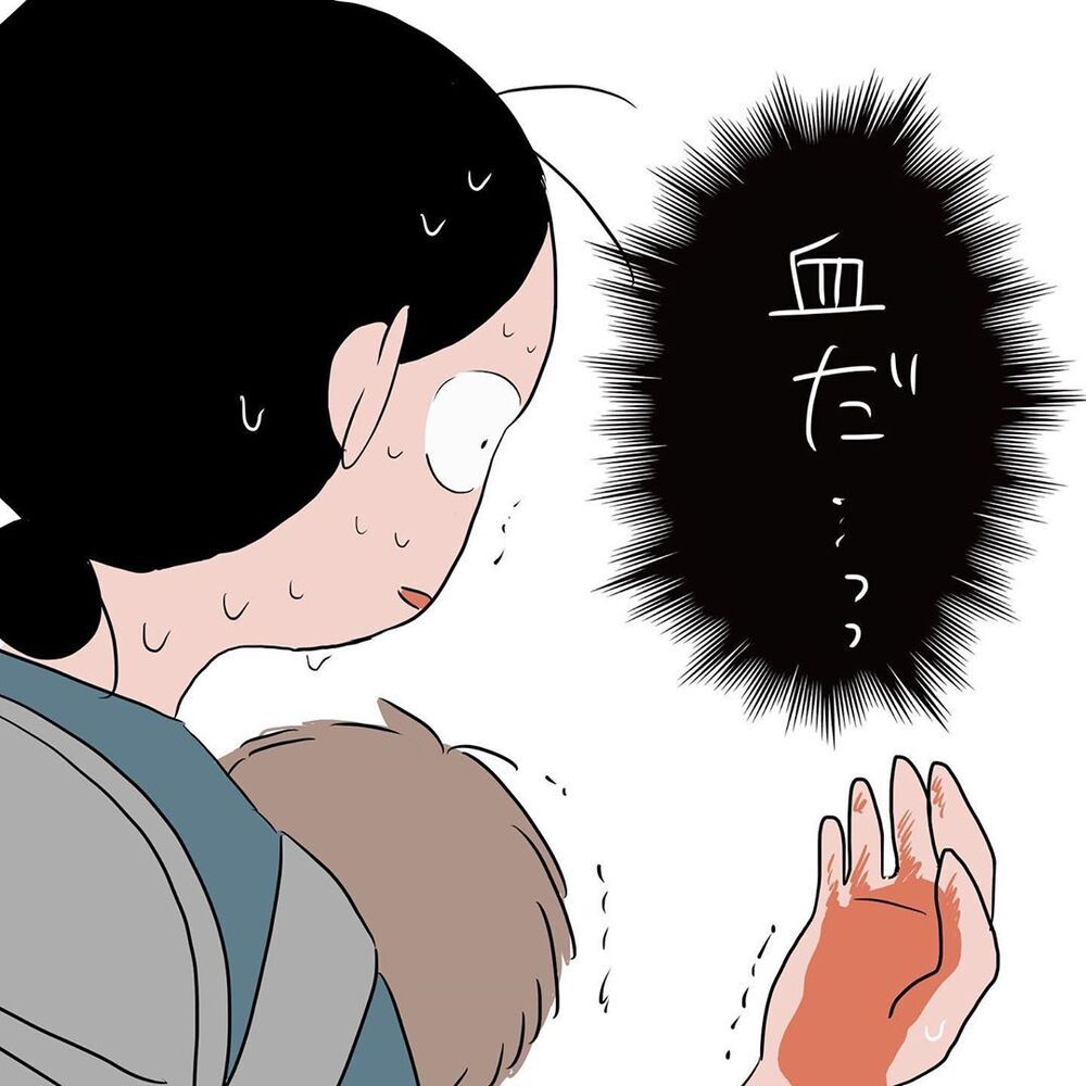 わが子の頭から大量出血…！　パニックの中急患センターへ【初めての子どもの大けが Vol.2】