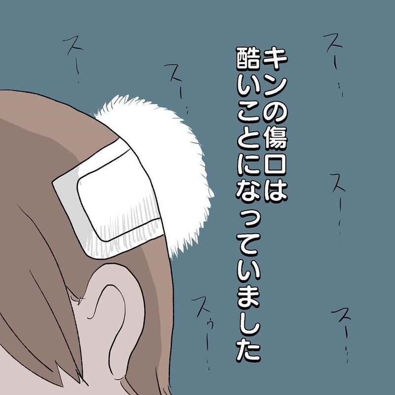 次なる病院へ…！　息子を安心させたくてした約束に後悔…【初めての子どもの大けが Vol.5】