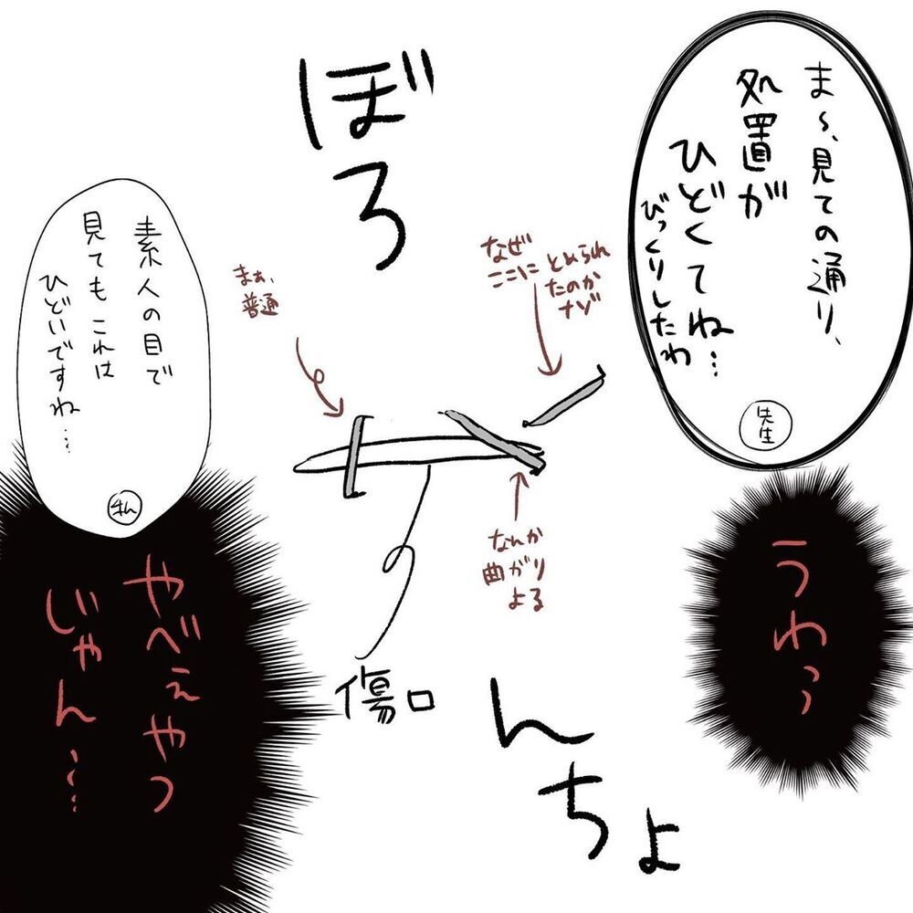 再処置の提案にいつもモジモジしている息子が自分の意見を口にする…！【初めての子どもの大けが Vol.7】
