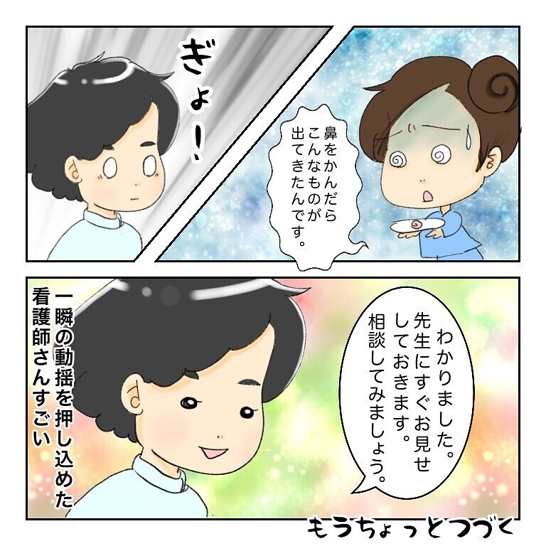 治療後に鼻をかんだら何かが出てきた　これは一体…？【鼻腔ガンになった話 Vol.30】