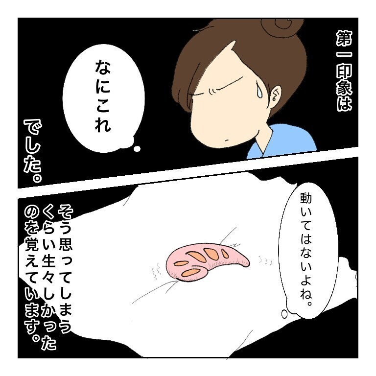 治療後に鼻をかんだら何かが出てきた　これは一体…？【鼻腔ガンになった話 Vol.30】