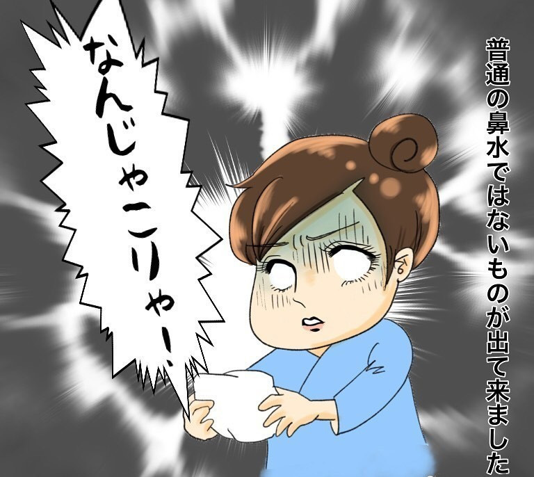 治療後に鼻をかんだら何かが出てきた　これは一体…？【鼻腔ガンになった話 Vol.30】