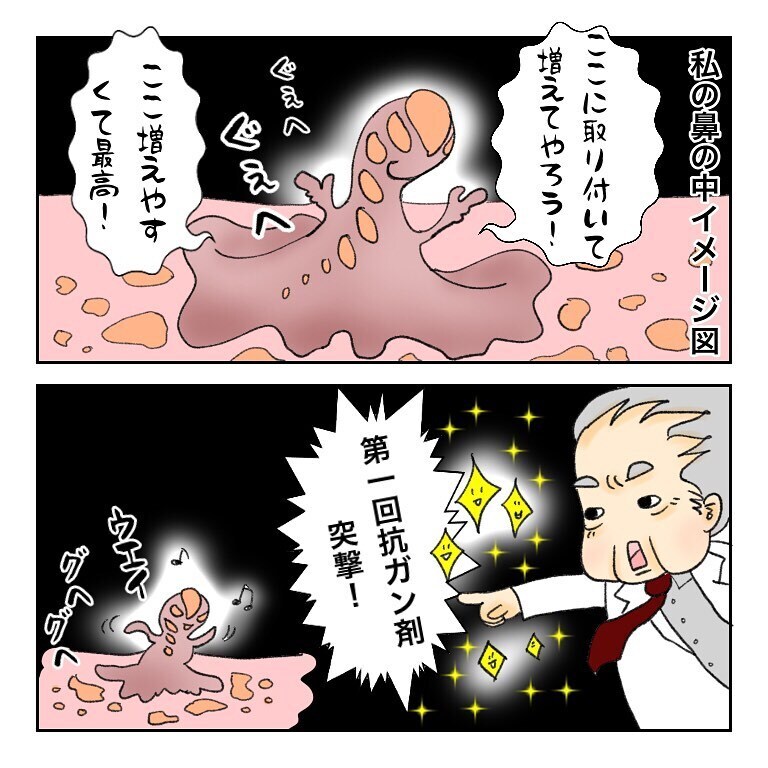 鼻から出てきた塊の正体は？  モヤモヤしながら先生に聞いてみた【鼻腔ガンになった話 Vol.31】