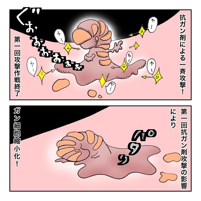 鼻から出てきた塊の正体は？  モヤモヤしながら先生に聞いてみた【鼻腔ガンになった話 Vol.31】