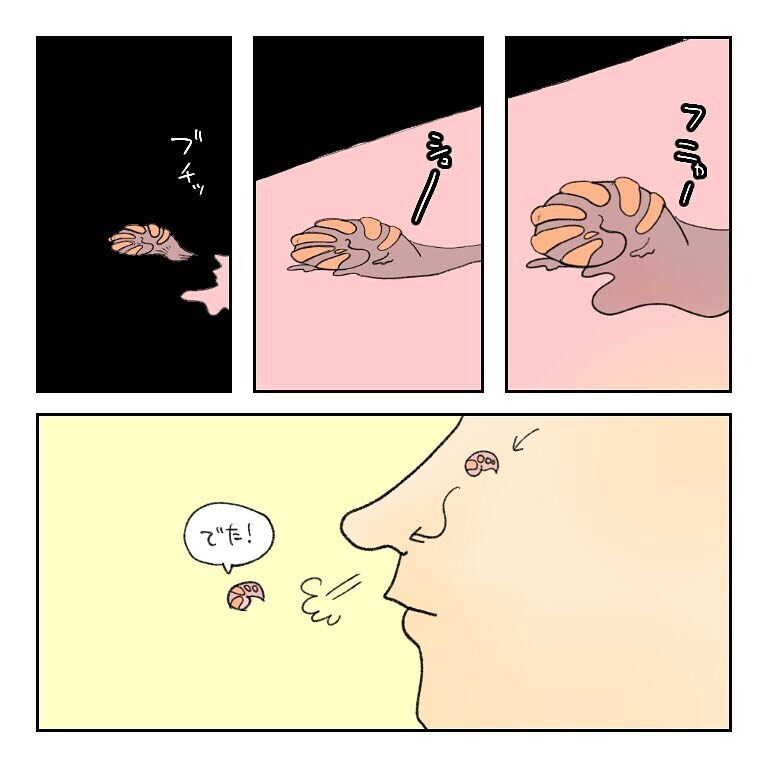 鼻から出てきた塊の正体は？  モヤモヤしながら先生に聞いてみた【鼻腔ガンになった話 Vol.31】