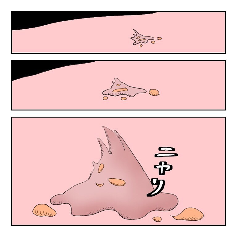 鼻から出てきた塊の正体は？  モヤモヤしながら先生に聞いてみた【鼻腔ガンになった話 Vol.31】